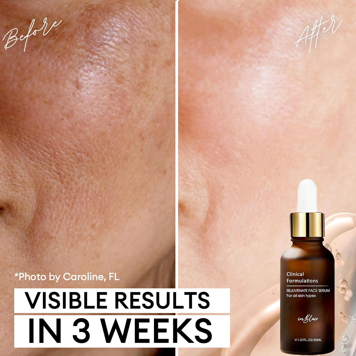 Inblair close-up label highlighting active ingredients and clean formula