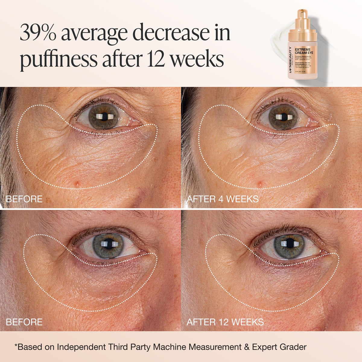 Innbeauty Project model applying cream under eye demonstrating visible smoothing