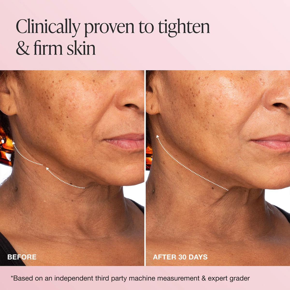 Innbeauty Project ingredient close-up emphasizing active components and visible firming benefit