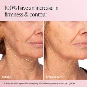 Innbeauty Project cream open jar displaying rich texture and fast-absorbing formula benefit