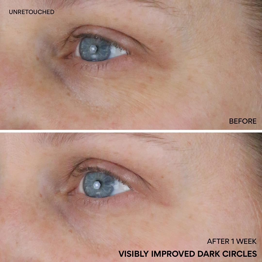 innisfree roll-on application on under-eye refreshing circulation