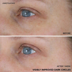 innisfree roll-on application on under-eye refreshing circulation