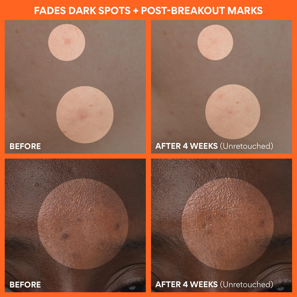 innisfree vitamin c capsules detail highlighting targeted brightening action