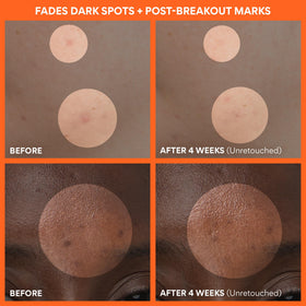 innisfree vitamin c capsules detail highlighting targeted brightening action