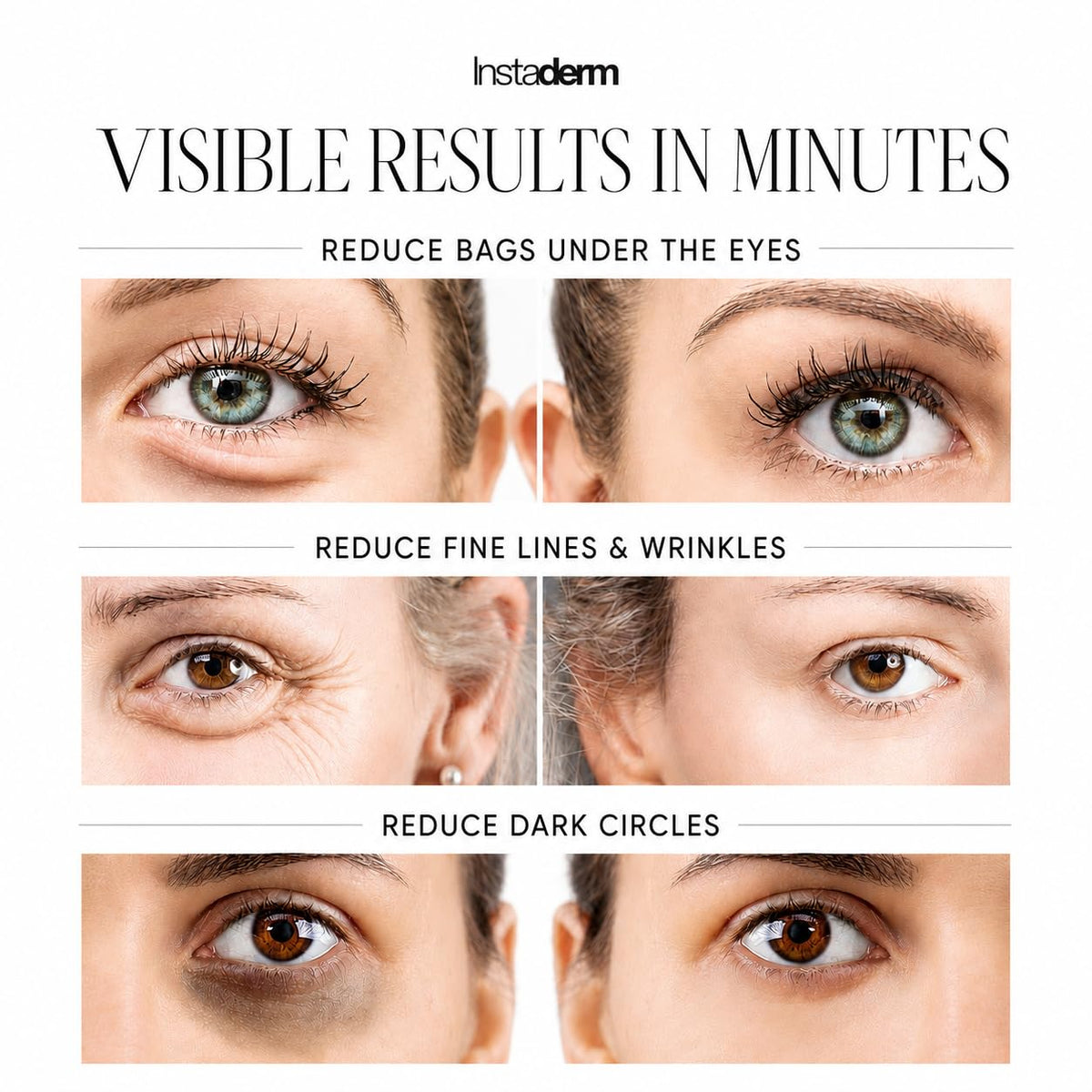 Instaderm application demo on under-eye area showing instant tightening