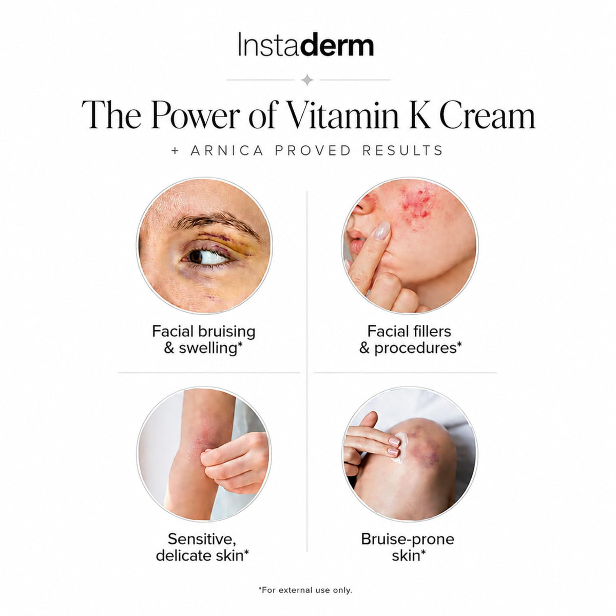 Instaderm being gently applied under eye to reduce the look of darkness and puffiness