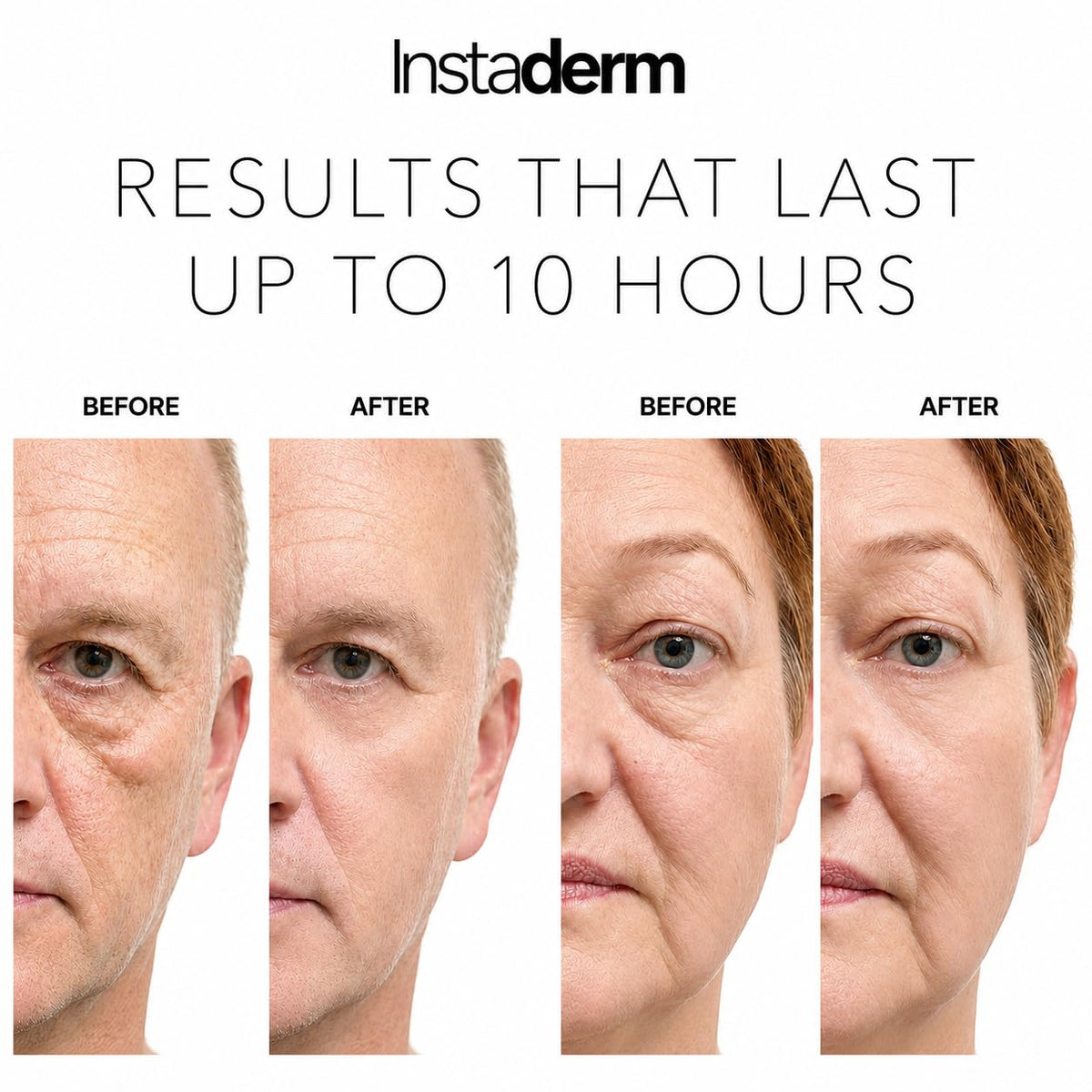 Instaderm before and after comparison highlighting reduced puffiness