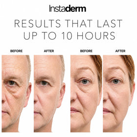 Instaderm before and after comparison highlighting reduced puffiness