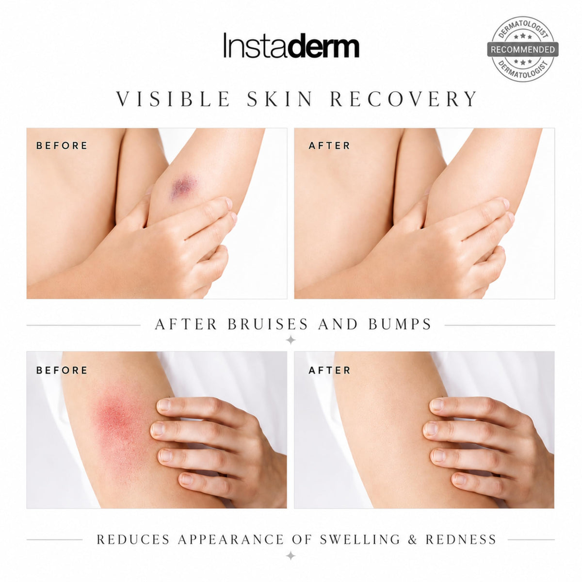 Instaderm ingredient label close-up highlighting vitamin K and arnica benefits