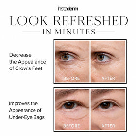 Instaderm lifestyle model applying cream for a confident refreshed look