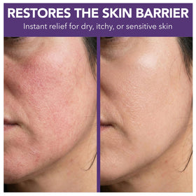 Intimate Rose balm on elbow and heel illustrating targeted dry skin care