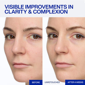 IOPE close-up of serum texture on skin, lightweight absorbent finish benefits skin