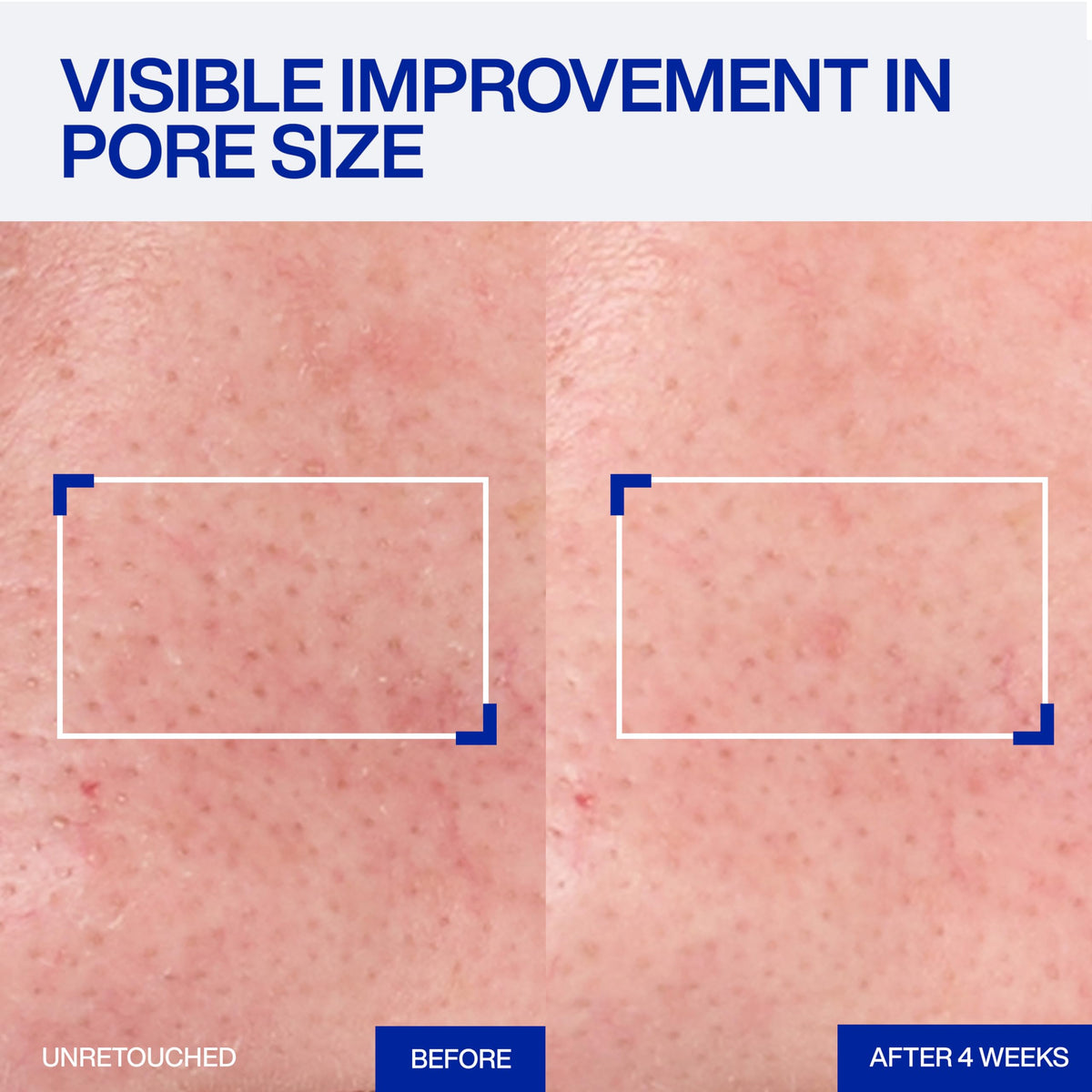 IOPE serum drop on fingertip showing lightweight texture benefit
