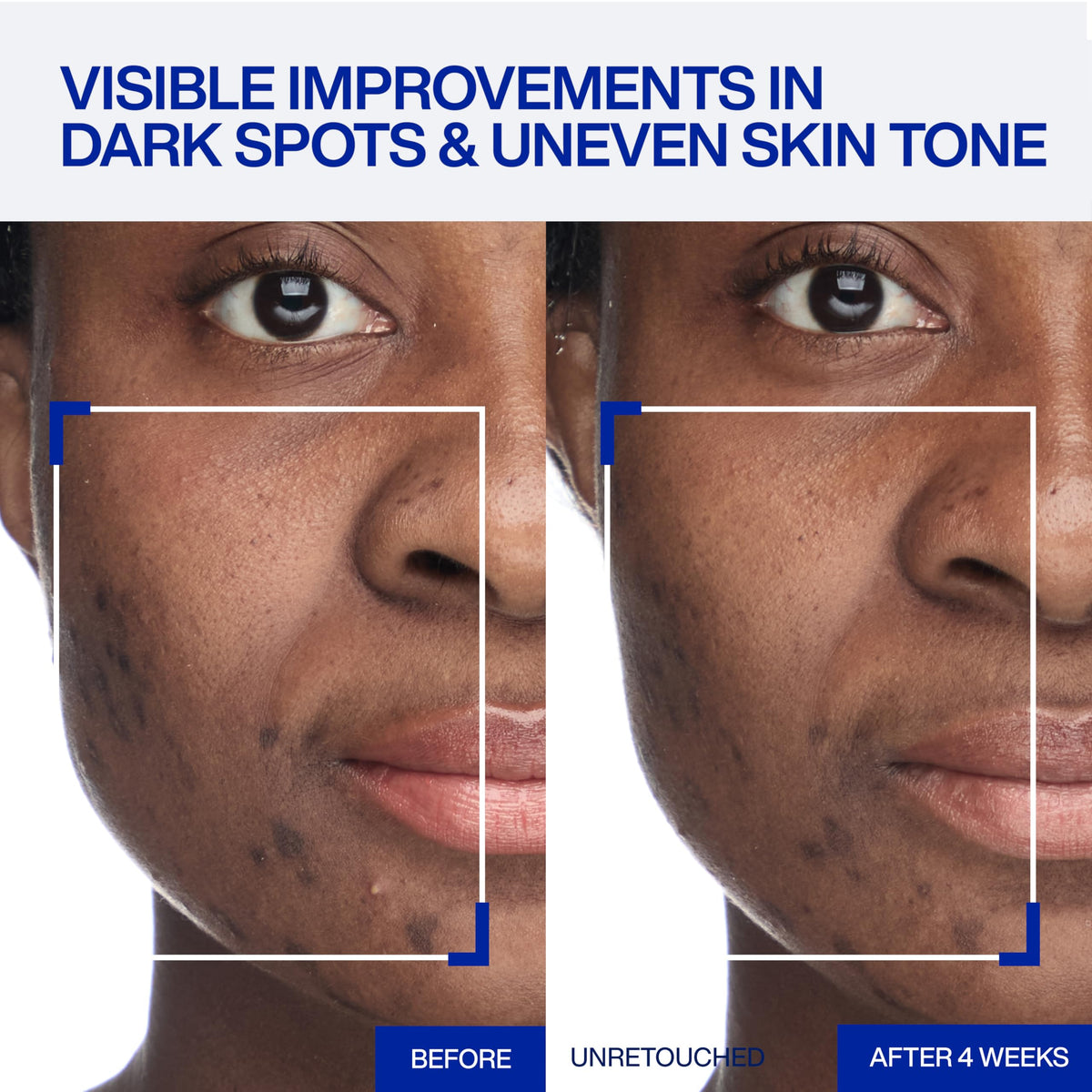 IOPE cream texture close-up melting into skin for weightless delivery