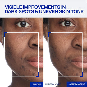 IOPE cream texture close-up melting into skin for weightless delivery