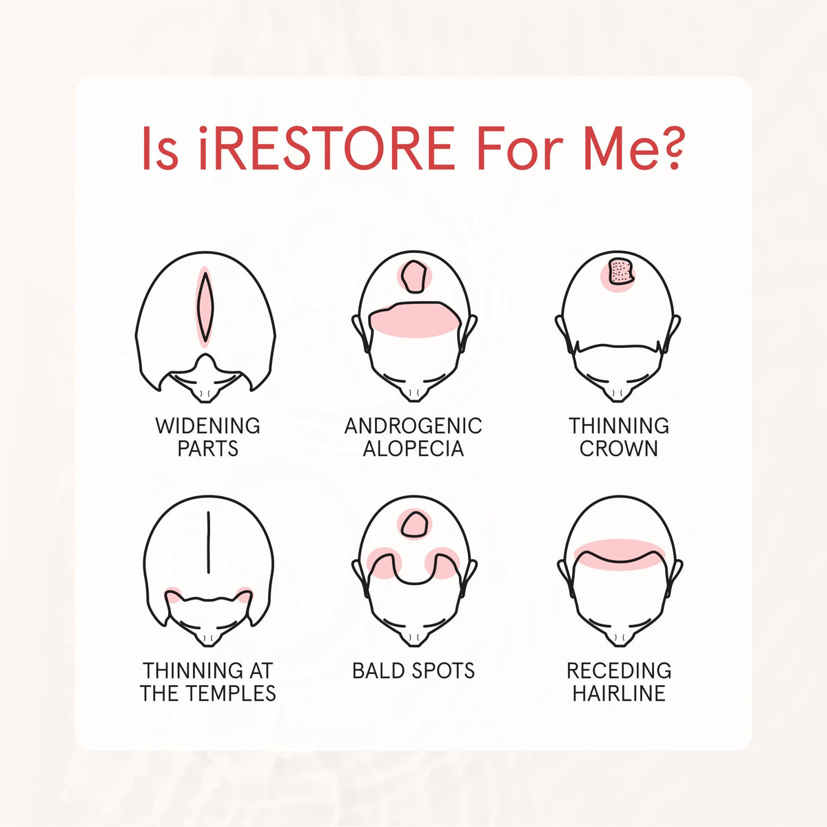 iRestore before and after length compare showing fuller-looking hair