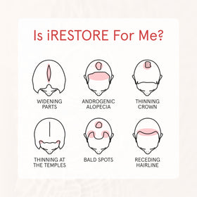iRestore before and after length compare showing fuller-looking hair