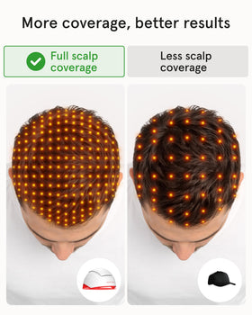 iRestore LED and laser array close-up showing targeted light distribution
