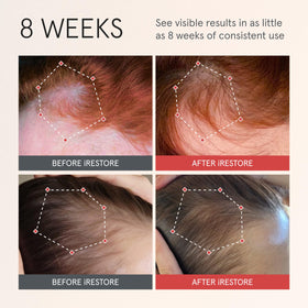 iRestore dropper dispensing serum texture for fast absorption