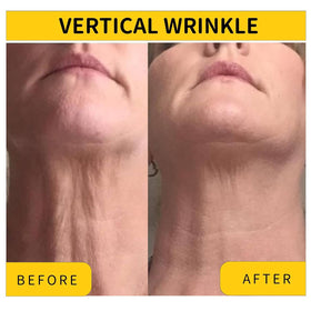 Irismistx applying cream to neck and jawline demonstrating lifting benefit