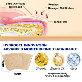 IRSRDOQU patch being applied to toenail demonstrating simple application