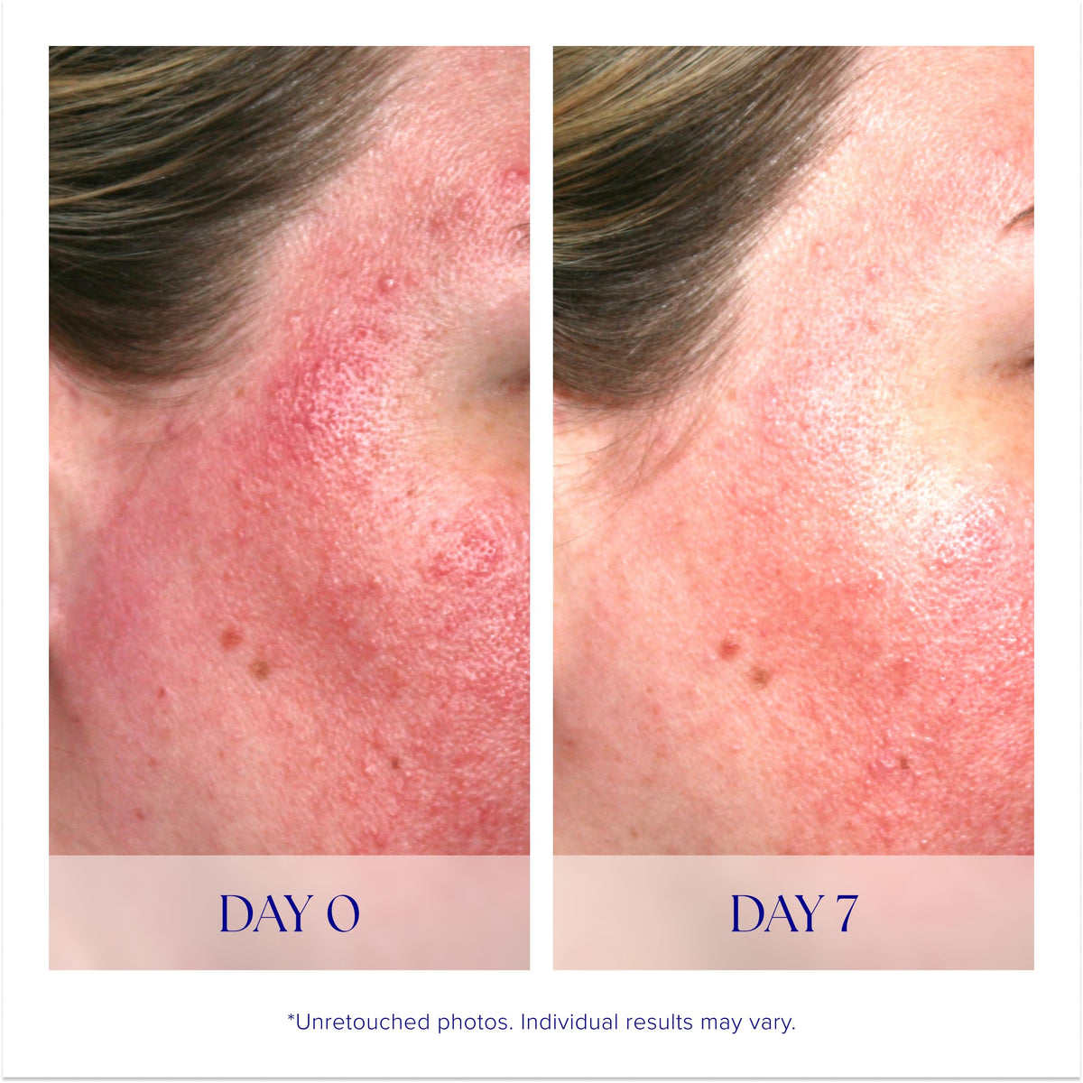 iS CLINICAL bottle in hand demonstrating 1 fl oz size and travel-friendly benefit