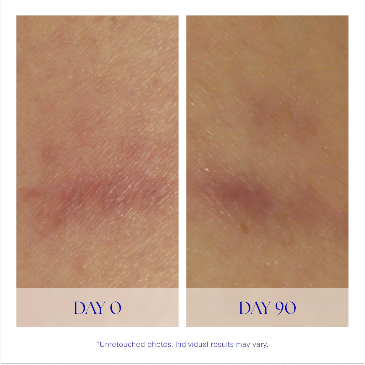 iS CLINICAL applying serum to hand demonstrating easy application and fast absorption