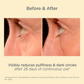 ISDIN applicator in use smoothing cream under the eye for immediate cooling