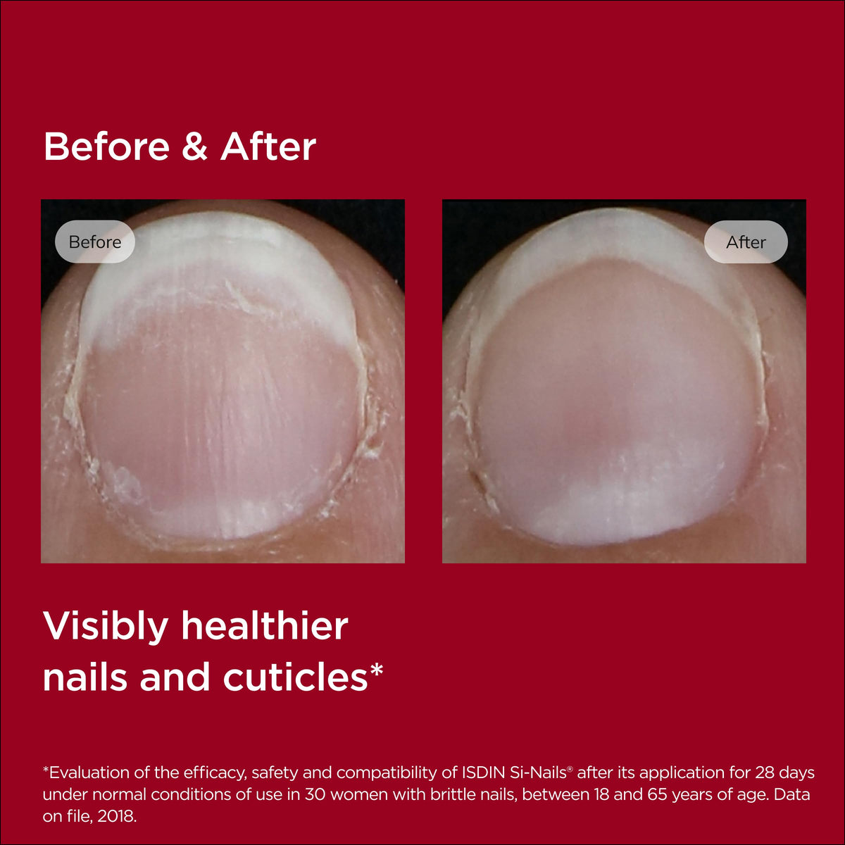 ISDIN Si-Nails label close-up displaying key ingredients and claims