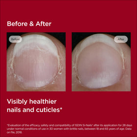 ISDIN Si-Nails label close-up displaying key ingredients and claims