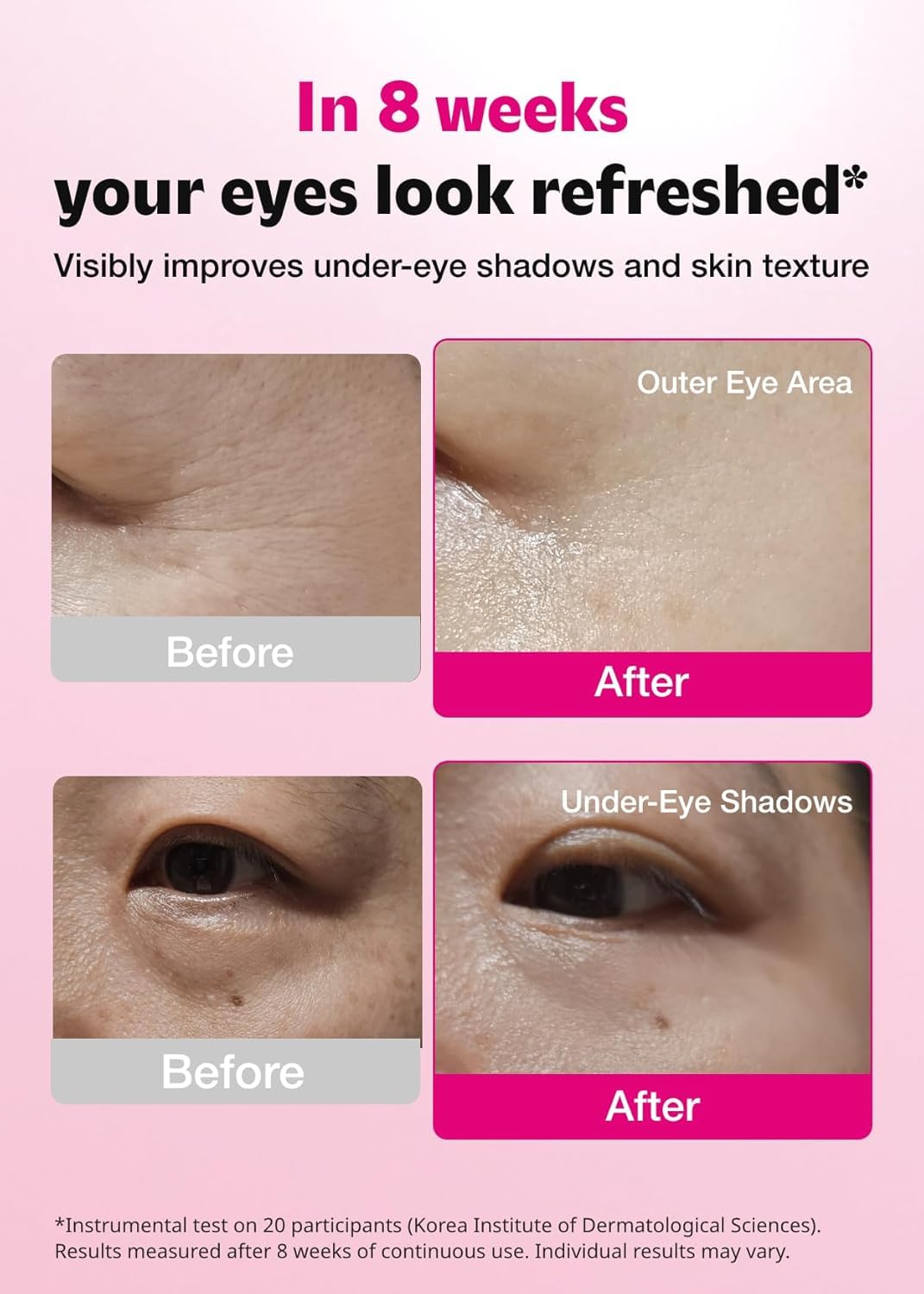 ISOI patch applied under eye demonstrating immediate cooling and de-puffing effect