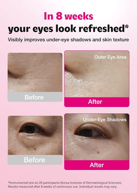 ISOI patch applied under eye demonstrating immediate cooling and de-puffing effect
