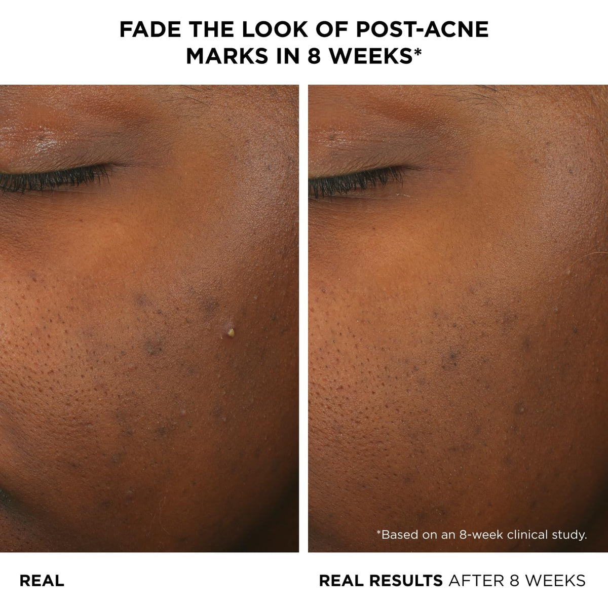 IT Cosmetics close-up of serum texture highlighting lightweight absorption
