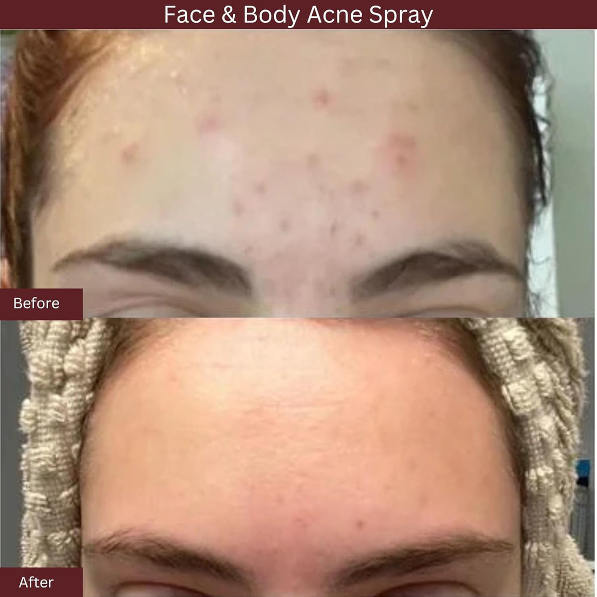 ITK salicylic acid texture droplet on skin illustrating lightweight absorption