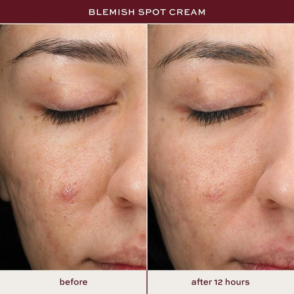 ITK tube dispensing spot treatment highlighting controlled application and precision