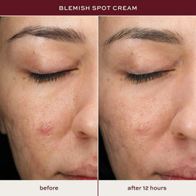 ITK tube dispensing spot treatment highlighting controlled application and precision