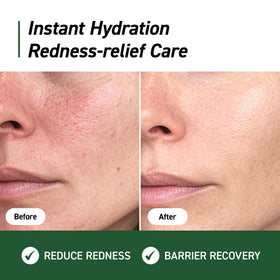 IVOSKIN cream texture close-up highlighting green tint and smooth spreadability