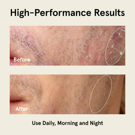 JAXON LANE label close-up listing enzymes and vitamins for skin renewal