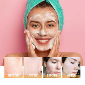 JISKG turmeric ingredient visual showing natural extract for brighter-looking skin
