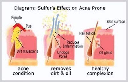 JOESOEF SKIN CARE scalp application in shower for targeted cleansing