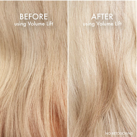 John Frieda before and after crown showing noticeable lift benefit