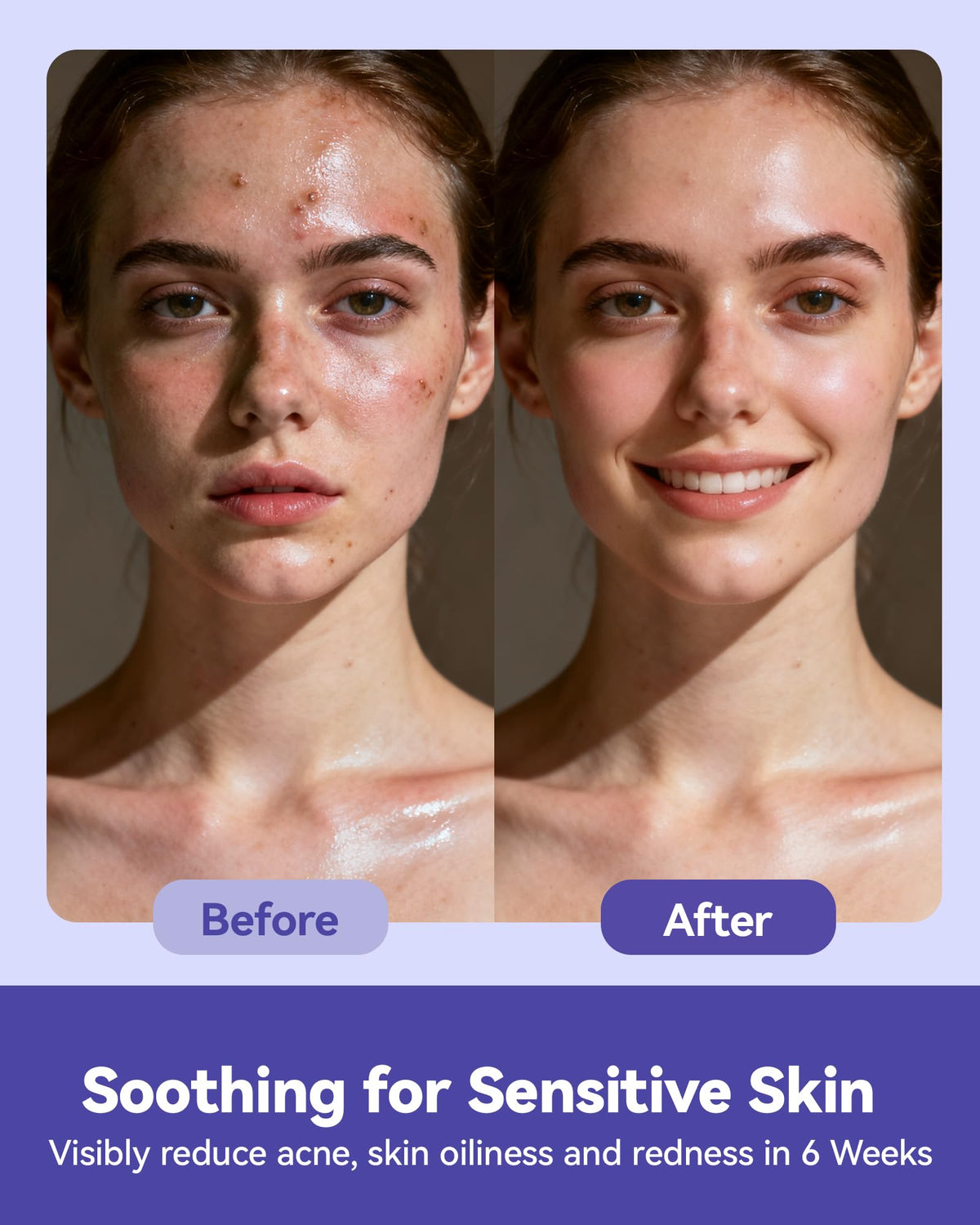 Jolly Care used on a baby cheek for gentle, safe cleaning