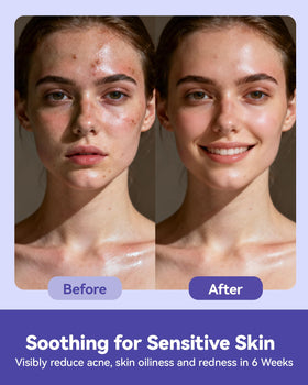 Jolly Care used on a baby cheek for gentle, safe cleaning