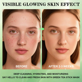 Josmon rinsed skin close-up showing smoother, refreshed texture