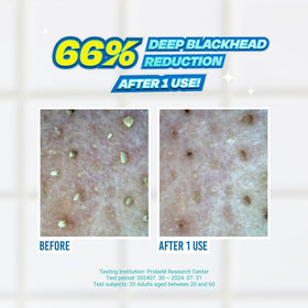 JUMISO dual-ended precision swabs close-up for gentle wipe and scrape