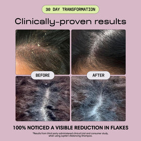 Jupiter serum dropper applying to scalp for targeted relief benefit