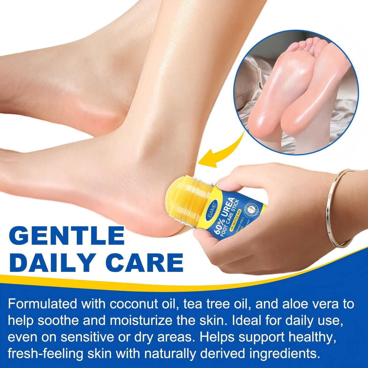 JWBVCTCR ingredients label closeup highlighting urea 60% and salicylic 2% strength