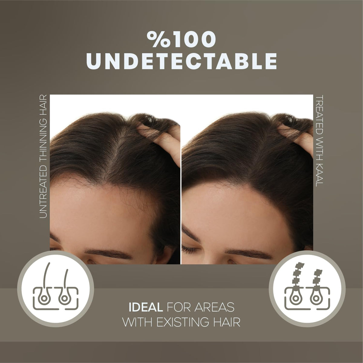 KAAL before and after comparison showing concealed thinning for renewed confidence