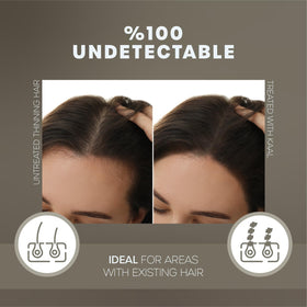 KAAL before and after comparison showing concealed thinning for renewed confidence