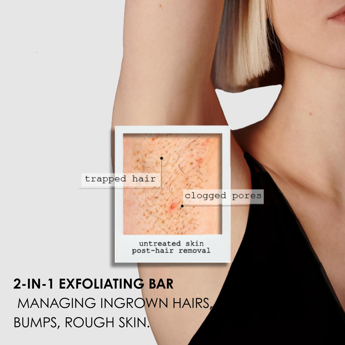 kaia naturals takesumi bright being applied to underarm to reduce bumps